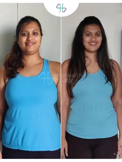 Front view of Ishani's 7kg weight loss.