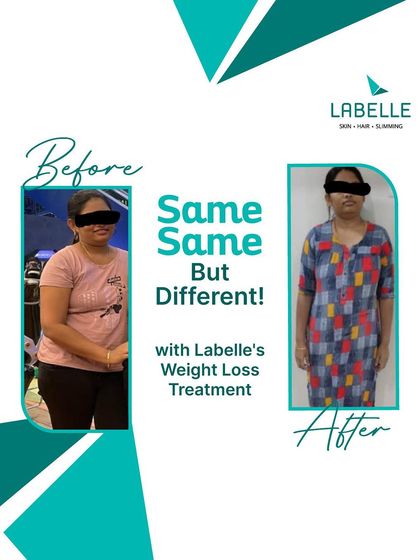 LaBelle - Body Contouring & Weight Management Real Results: Before & After photo 6
