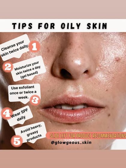 This graphic provides a quick summary of the key tips for managing oily skin. Following these five steps consistently can make a significant difference in controlling shine and preventing acne.