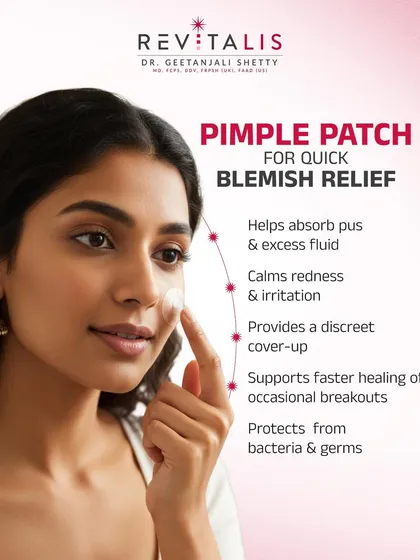 How Pimple Patches Provide Quick Blemish Relief. Pimple patches are more than just a cover-up. They are hydrocolloid dressings that absorb fluid, calm redness, and protect the blemish from bacteria and picking, helping it heal faster.