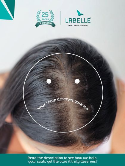 LaBelle - Hair Loss Treatment & Restoration Ask Our Experts: Hair Care Insights photo 6