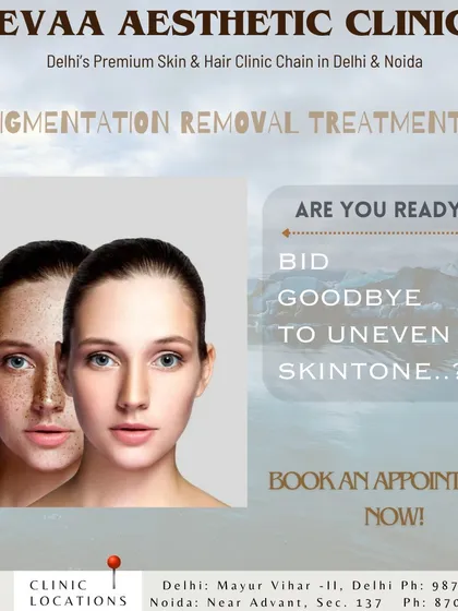 Are you ready to say goodbye to uneven skin tone? Our pigmentation removal treatments are designed to give you the clear, even complexion you desire.