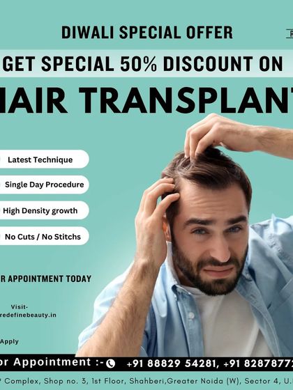 Our Diwali special offer provides a 50% discount on hair transplant procedures. This single-day procedure offers high-density growth with no cuts or stitches.
