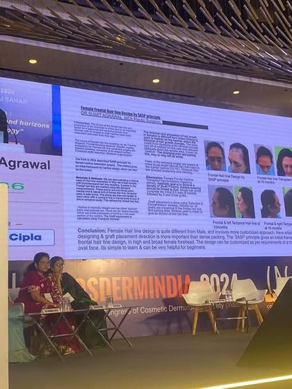 Presenting my case study on female hair transplant at a major aesthetic conference. It is crucial to understand that female pattern hair loss is different and requires a unique, nuanced approach to restoration.