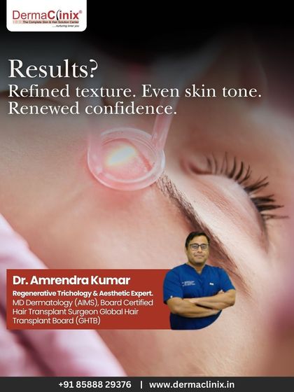 This image features Dr. Amrendra Kumar, our aesthetic expert, alongside a depiction of a laser treatment. The result is refined skin texture, an even tone, and renewed confidence for our patients.