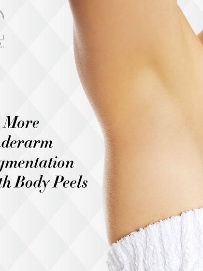 Say no more to underarm pigmentation with my specialized body peels, perfect for those who feel shy about wearing sleeveless clothes.