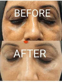 Advanced Facials & Skin Rejuvenation