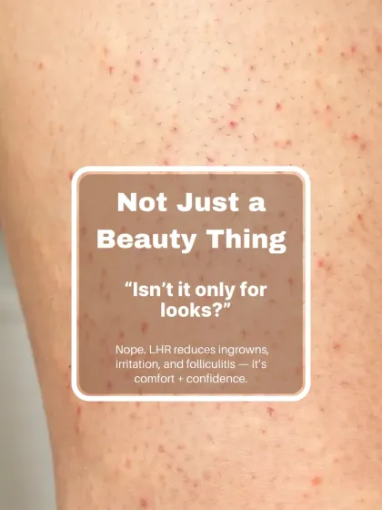 Laser Hair Reduction is not just a beauty treatment. For many of my patients, it is a solution for medical issues like ingrown hairs (folliculitis) and the irritation that comes with it, providing comfort and confidence.