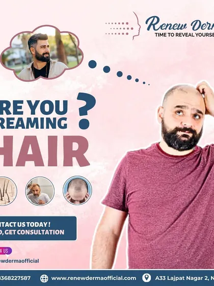 If you are dreaming of a fuller head of hair, a consultation is the first step. We can assess your hair loss and discuss permanent solutions like hair transplantation to help you achieve your goals.