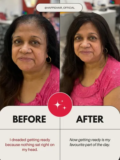 When you don't feel like yourself, even getting ready can feel like a chore. This client's smile shows the joy of looking in the mirror and loving what you see again.