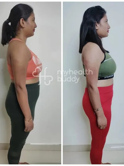 The side profile of Sangita's 5 kg weight loss journey. She built consistency and was motivated by her coach every step of the way.