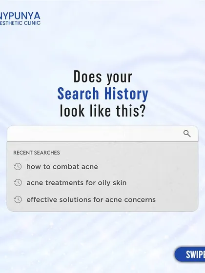 Does your search history look like this? If you're constantly looking for acne solutions online, it's time to consult an expert. I can provide a clear diagnosis and an effective treatment plan.