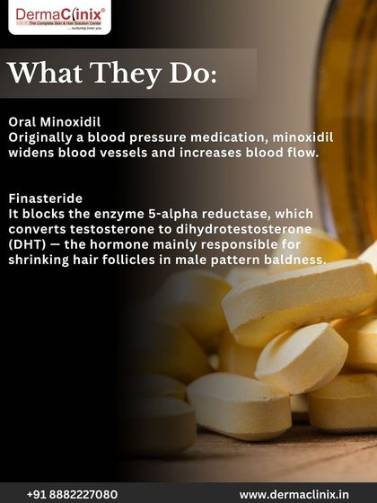 This graphic explains what common oral medications do. Minoxidil increases blood flow, while Finasteride blocks the DHT hormone responsible for male pattern baldness.