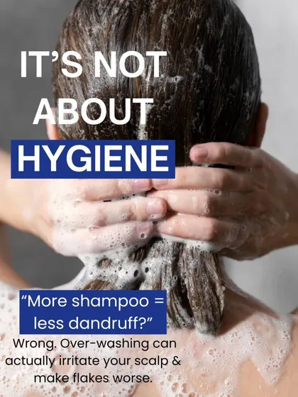 Many people think washing their hair more will cure dandruff, but over washing can irritate the scalp and make it worse. The key is using the right medicated shampoo, not washing more frequently.