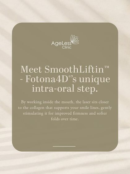 The SmoothLiftin™ step is what makes the Fotona4D® treatment so unique. By working inside the mouth, the laser sits closer to the collagen that supports your smile lines, gently stimulating it to improve firmness and soften folds over time.