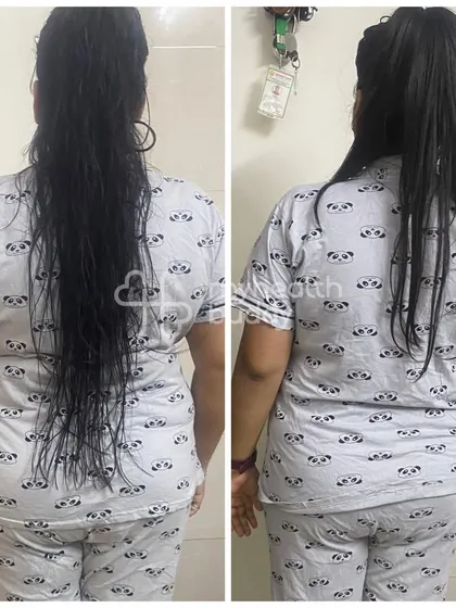 The back view of Vidhi's transformation. Her journey is a powerful example of how fitness can positively impact overall health.