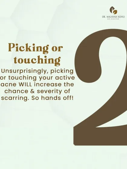 The second major factor is mechanical trauma from picking or touching active acne lesions. This action introduces more bacteria, increases inflammation, and damages the skin's delicate structure, significantly increasing the chance and severity of scarring.