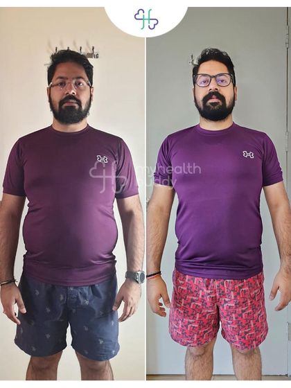 Front view of Anshul's 10kg transformation.