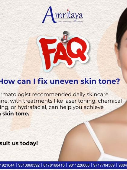 An FAQ about fixing uneven skin tone. We recommend a dermatologist-approved routine combined with treatments like laser toning, chemical peeling, or Hydrafacial for best results.