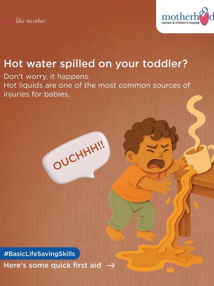 A spilled cup of hot tea or coffee is a common cause of scalds in toddlers. These accidents happen in an instant. This series shows you the correct first aid steps to take immediately after a burn to minimize injury.