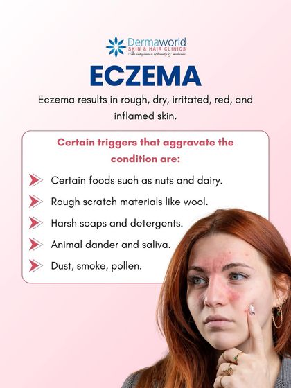 Eczema causes rough, dry, and inflamed skin, and certain triggers can make it worse. Identifying your specific triggers, whether they are foods like nuts, materials like wool, or environmental factors like dust, is key to managing the condition.