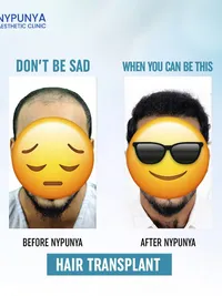 Hair Restoration