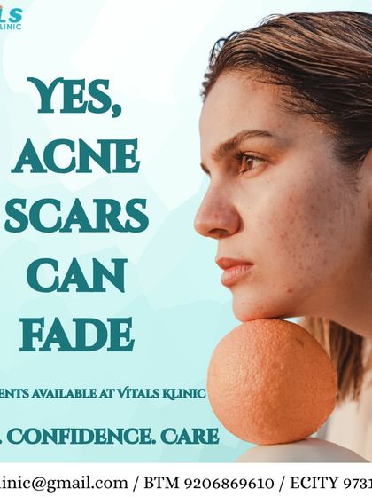 Vitals Klinic - Aesthetic Dermatology Acne & Scar Solutions photo 4