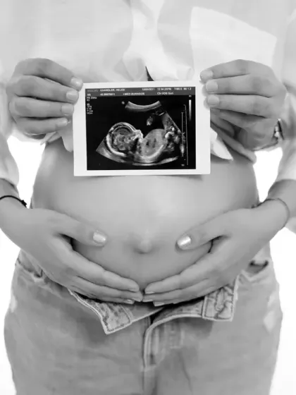 The black and white version of the sonogram photo adds a timeless, artistic quality. It turns a modern medical image into a piece of family history.