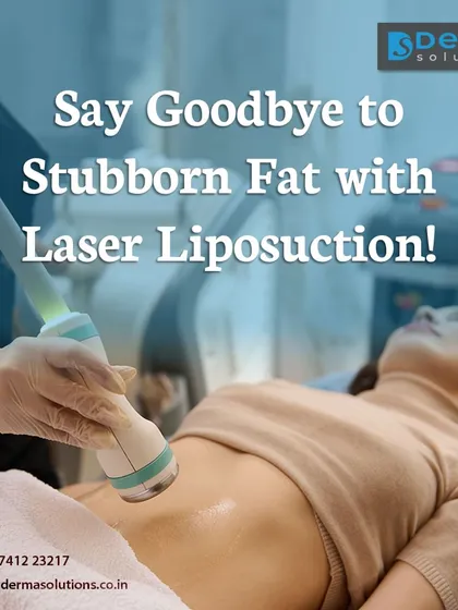 This image shows a Laser Liposuction treatment in progress on the abdominal area. I use focused laser energy to gently liquefy fat cells, allowing for precise body sculpting and contouring. This minimally invasive technique is excellent for achieving a more defined and toned physique.