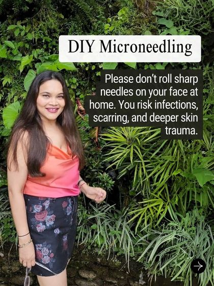 Myth: DIY microneedling at home is safe. Reality: Please do not roll sharp needles on your face at home. You risk serious infections, scarring, and deeper skin trauma. This procedure should only be done by a professional.