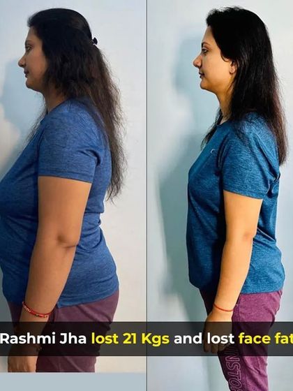 A side-profile view of Rashmi's 21kg transformation, showing a significant reduction in body fat and improved posture.