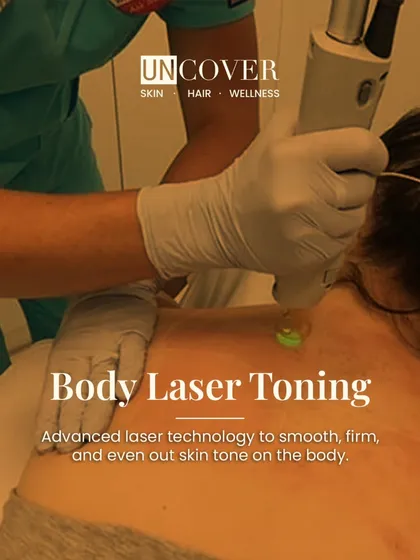 This is our Body Laser Toning treatment in action. We use advanced laser technology to improve the texture and tone of the skin on the body. It’s an excellent option for smoothing and firming areas like the back, arms, and legs, helping to even out skin tone.