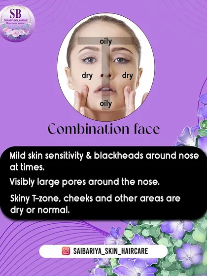 Another look at the characteristics of a combination face. You might have an oily T-zone with blackheads around the nose, but dry or normal cheeks.