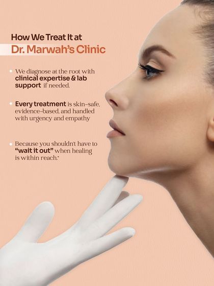 Our approach to treating skin barrier issues begins with a root-cause diagnosis, supported by lab work if needed. Every treatment is evidence-based, skin-safe, and handled with urgency and empathy, because healing should not have to wait.