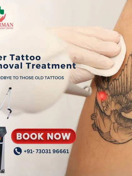 Unwanted tattoos can be a thing of the past. This image showcases my advanced laser tattoo removal service, which safely and effectively fades ink to restore your skin's natural appearance.