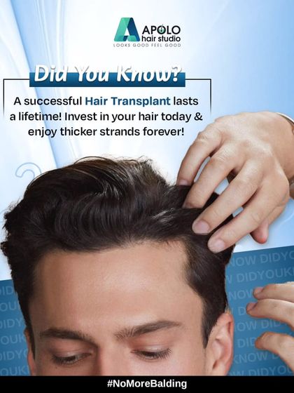 Did you know a successful hair transplant lasts a lifetime? It's not a temporary fix. It's a permanent investment in your hair and your confidence, giving you thicker strands forever.