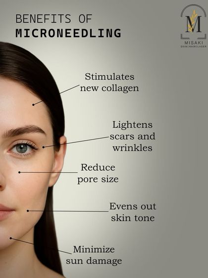 An infographic detailing the many benefits of microneedling, from stimulating new collagen and reducing pore size to evening out skin tone.