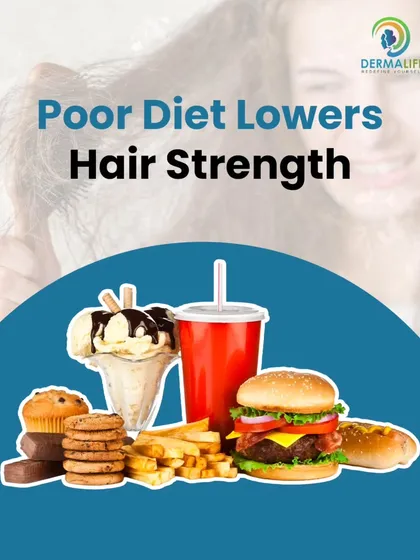 A poor diet lacking essential nutrients can significantly lower your hair's strength, especially during stressful seasons like monsoon.