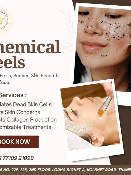 This graphic illustrates the process and benefits of chemical peels. I use them to exfoliate dead skin cells, treat various skin concerns, and boost collagen production for fresh, radiant skin.