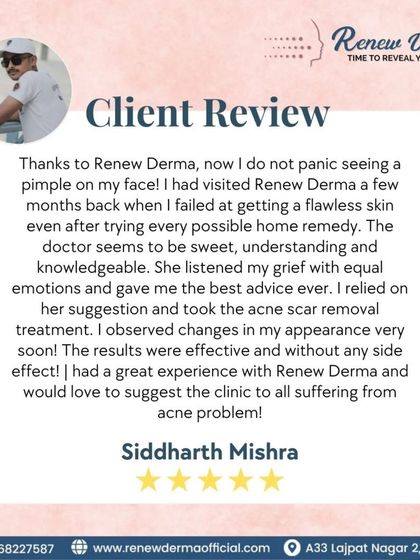 "I had a great experience with Renew Derma." A wonderful review from Siddharth, who found relief from his acne problem after trying our acne scar removal treatment.