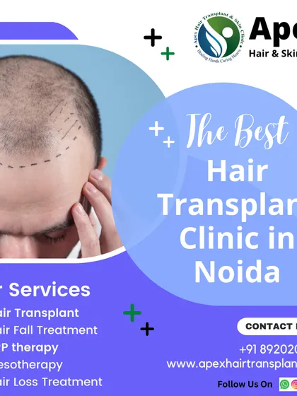 We believe in providing world-class hair restoration that is also accessible. This graphic outlines our key services, including FUE hair transplant and PRP therapy, and our promise of guaranteed results with easy EMI options available.