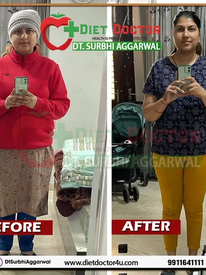 A duplicate view of Ms. Yashika's incredible 10 kg weight loss in 3 months postpartum. Her success highlights the effectiveness of a guided nutrition plan for new mothers.