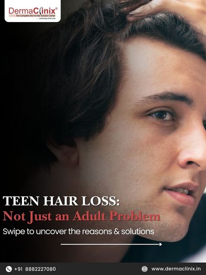 Teen hair loss is more common than many think. This post begins a series to uncover the reasons, from hormonal imbalances to styling, and the solutions available.