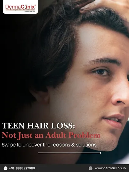Hair loss isn't just an adult problem. This post introduces the topic of teen hair loss and its various causes and solutions.