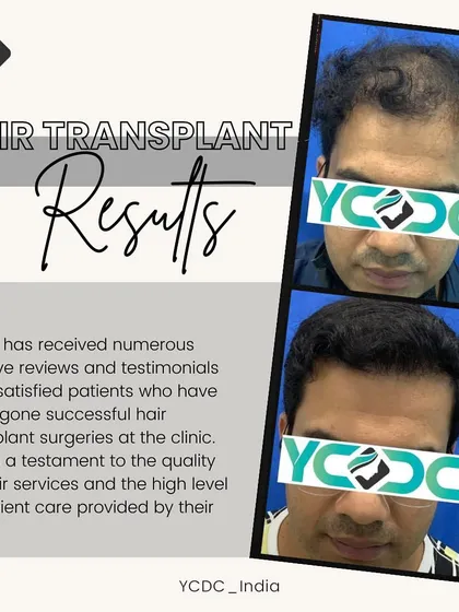 This graphic combines a powerful before-and-after result with a note on patient satisfaction, emphasizing the quality of care and successful outcomes at my clinic.