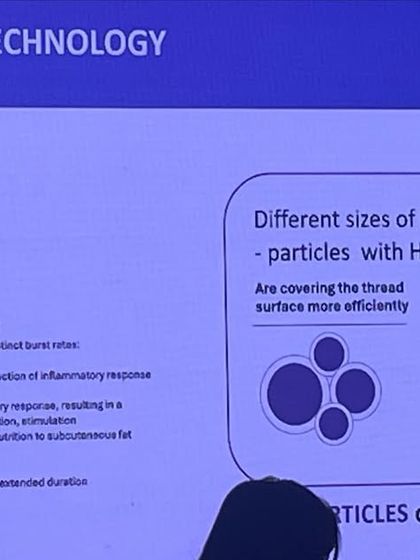 I use the latest 4th generation Aptos NAMICA threads, which feature advanced technology for targeted delivery and controlled release of Hyaluronic Acid (HA). This enhances collagen production and provides longer-lasting results.