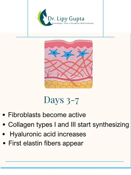 From days 3 to 7, fibroblasts become active and start producing new Type I and III collagen. Your skin also begins to produce more of its own hyaluronic acid.