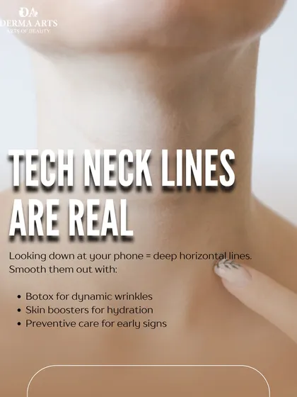 Tech neck lines are a real concern. This image explains how Botox and skin boosters can smooth the deep horizontal lines caused by looking down at phones.