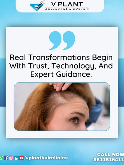 Real transformations are built on a foundation of trust, technology, and expert guidance. We partner with you throughout your journey, using our expertise to address issues like a receding hairline and deliver results that restore both your hair and your self-esteem.