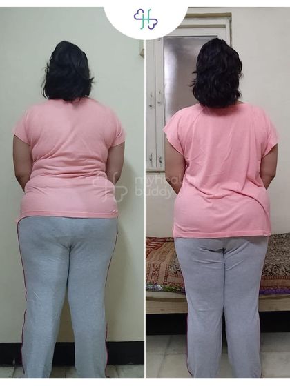 Losing 9 kgs in 12 weeks while managing PCOD and Thyroid. This client discovered that sustainable diets and constant support make the journey amazing.